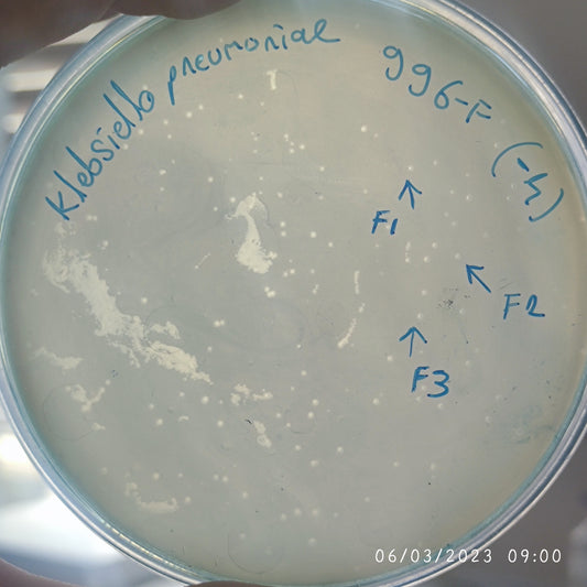 Klebsiella pneumoniae bacteriophage 180996F