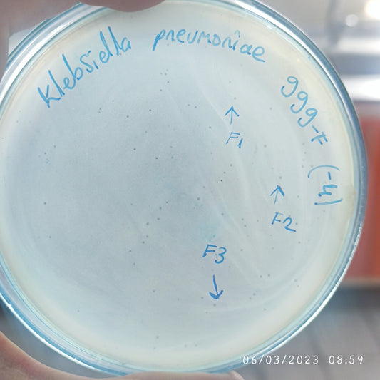 Klebsiella pneumoniae bacteriophage 180999F