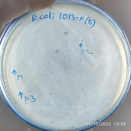 Escherichia coli bacteriophage 101013F
