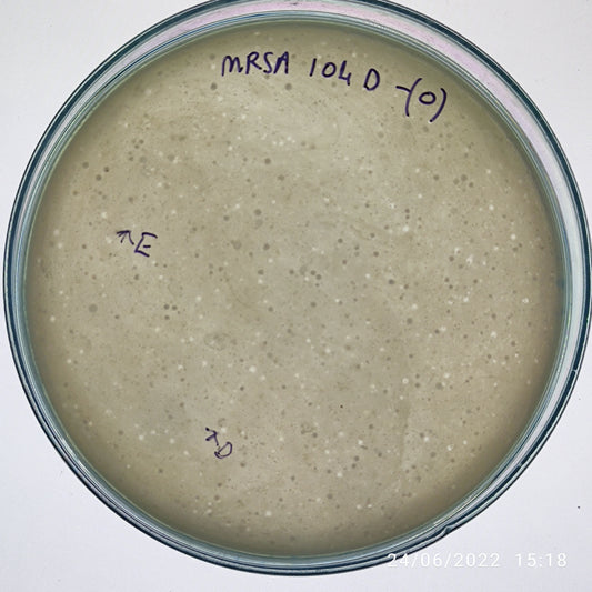 Staphylococcus aureus bacteriophage 150104D