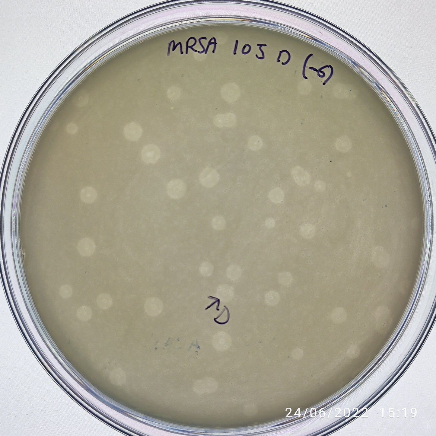 Staphylococcus aureus bacteriophage 150105D