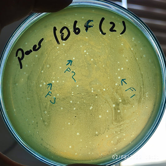 Pseudomonas aeruginosa bacteriophage 130106F
