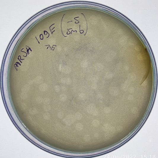 Staphylococcus aureus bacteriophage 150109E