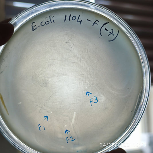 Escherichia coli bacteriophage 101104F