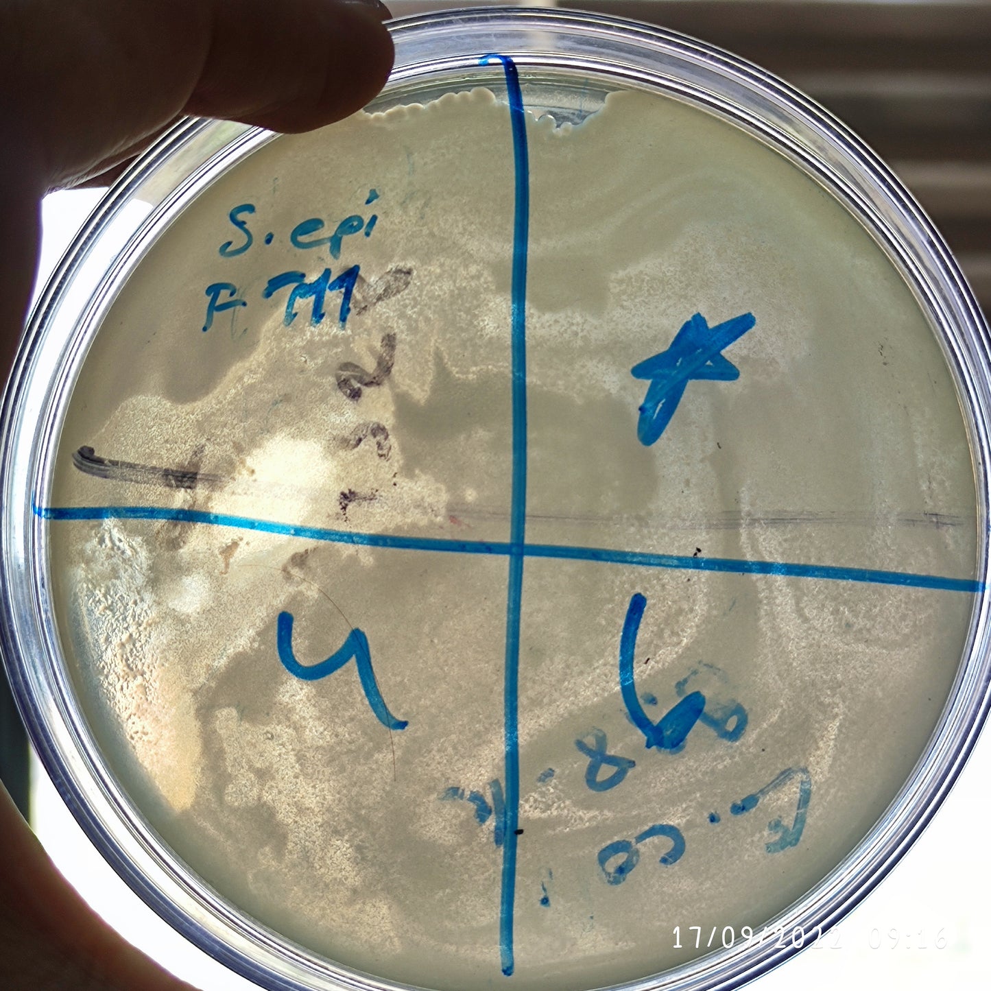 Staphylococcus epidermidis bacteriophage 158111F