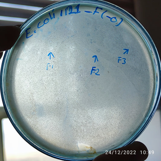 Escherichia coli bacteriophage 101121F