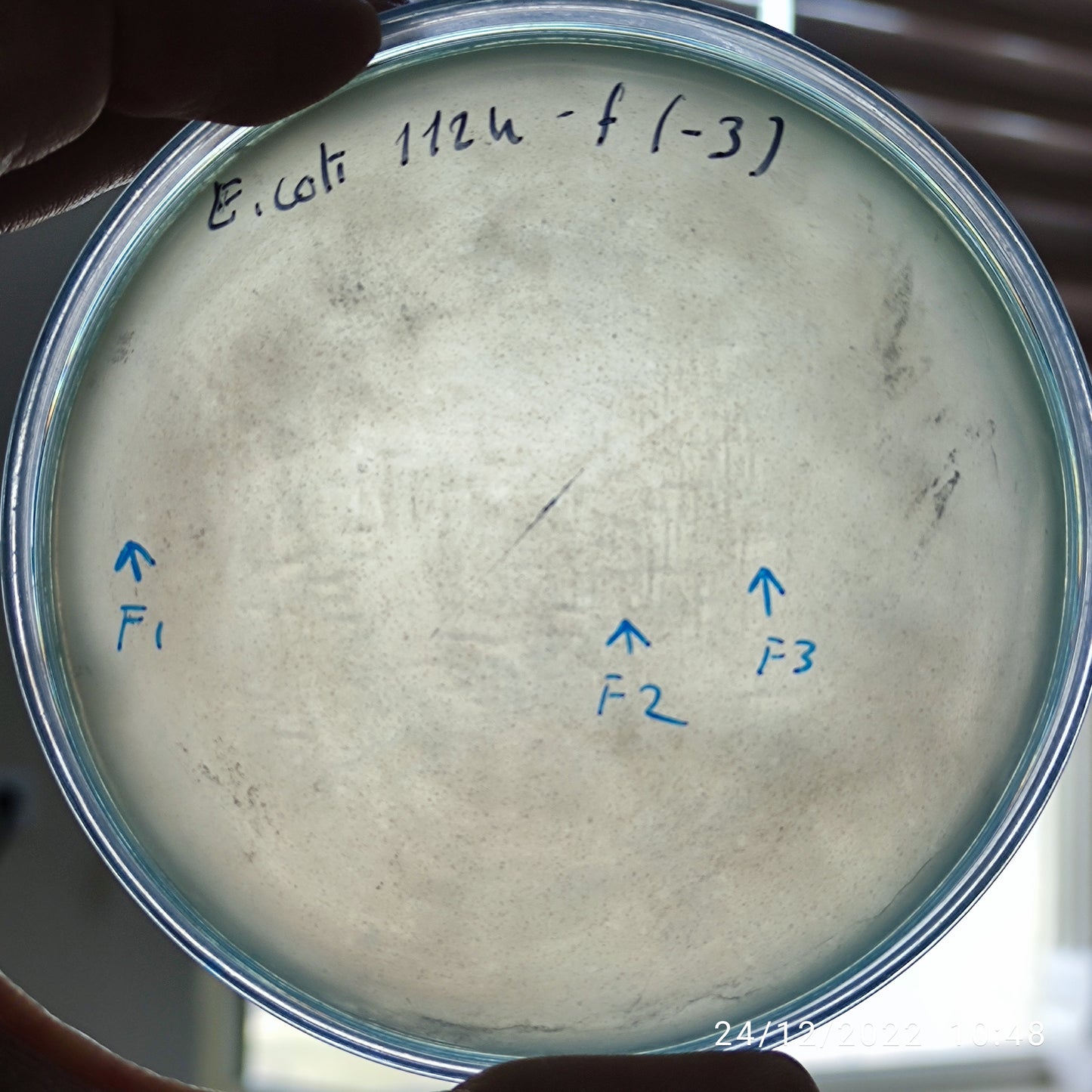 Escherichia coli bacteriophage 101124F