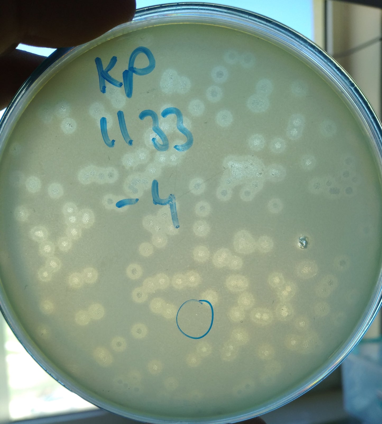 Klebsiella pneumoniae bacteriophage 181133A