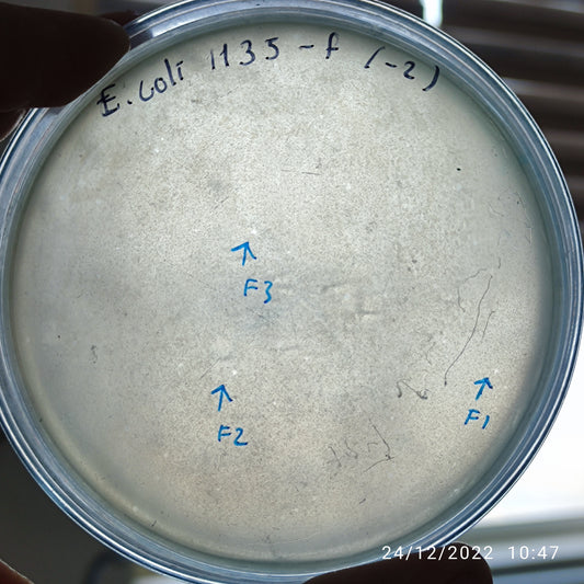 Escherichia coli bacteriophage 101135F