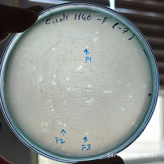 Escherichia coli bacteriophage 101140F