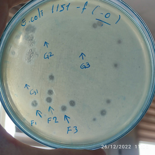 Escherichia coli bacteriophage 101151G
