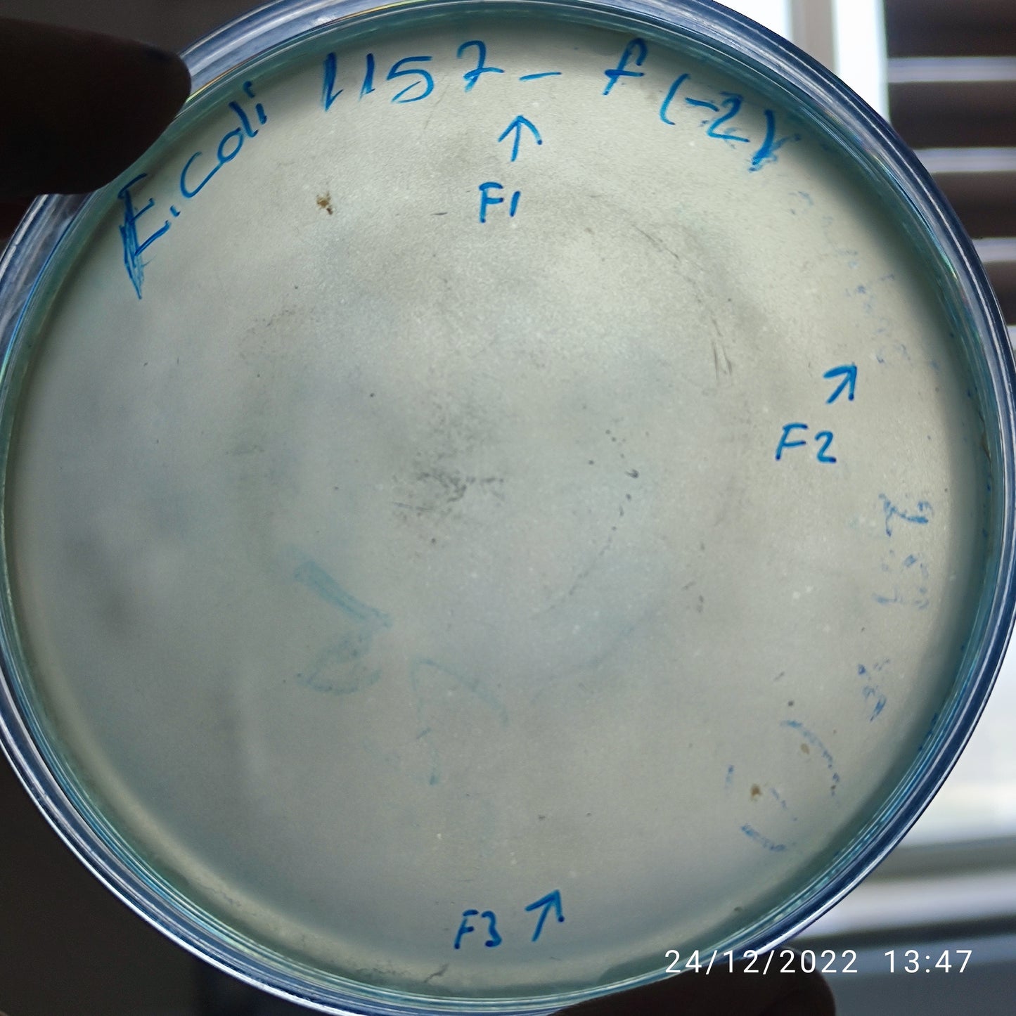 Escherichia coli bacteriophage 101157F