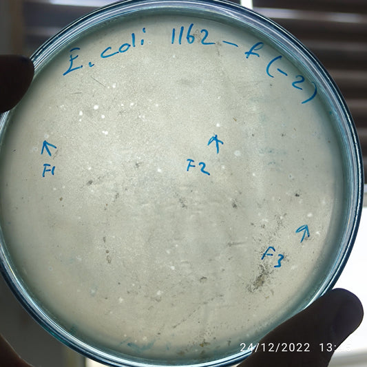 Escherichia coli bacteriophage 101162F