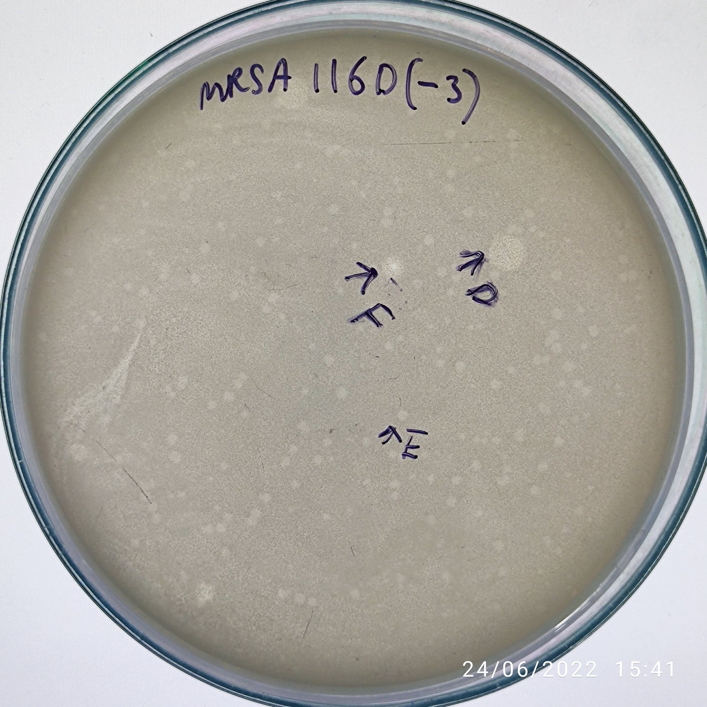 Staphylococcus aureus bacteriophage 150116D