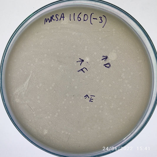 Staphylococcus aureus bacteriophage 150116D