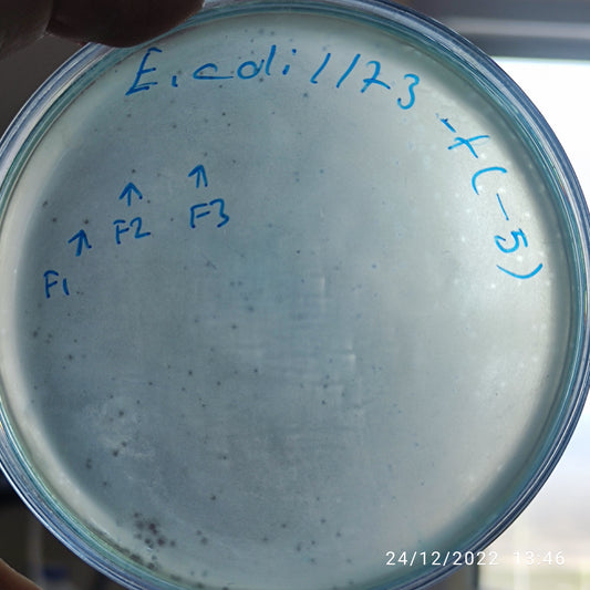 Escherichia coli bacteriophage 101173F