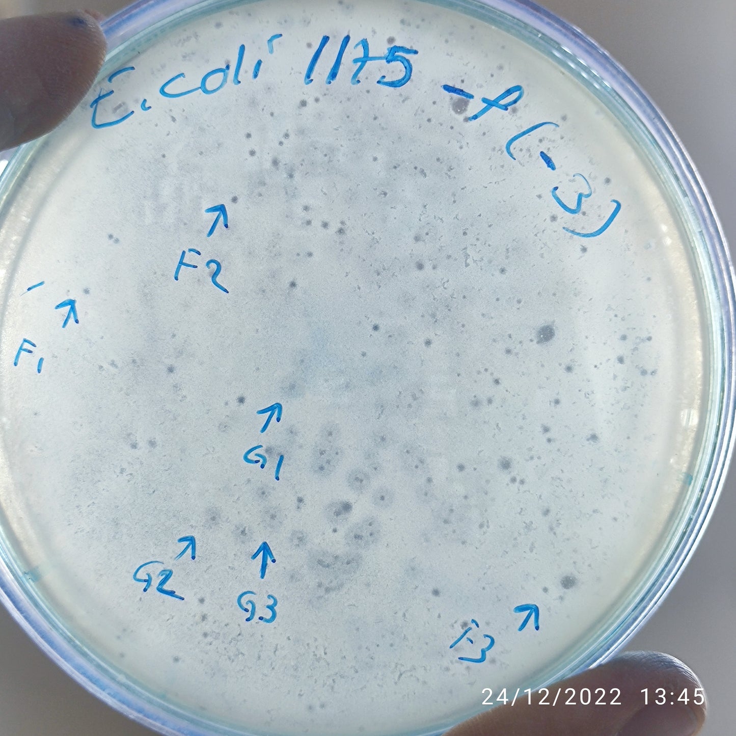 Escherichia coli bacteriophage 101175F