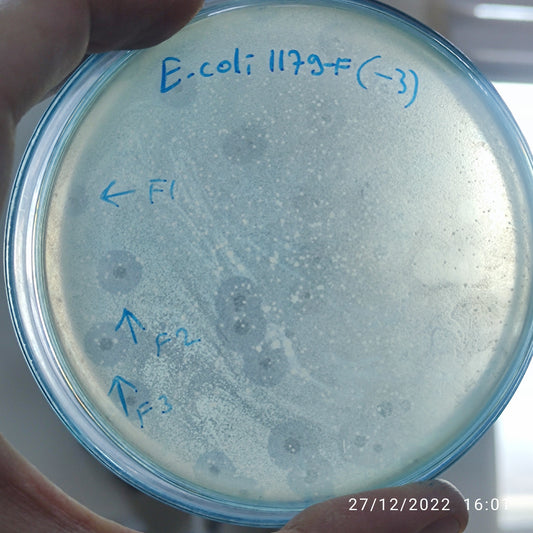 Escherichia coli bacteriophage 101179F