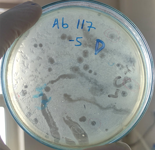 Acinetobacter baumannii bacteriophage 120117D