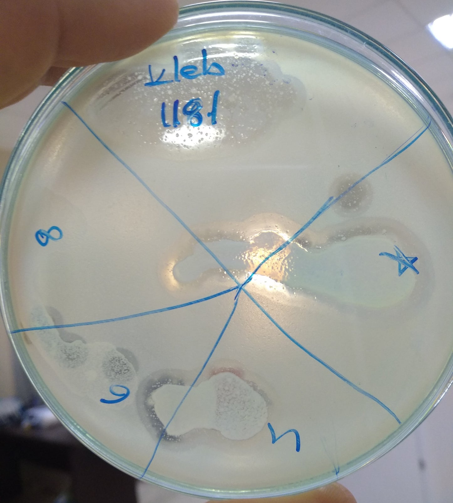 Klebsiella pneumoniae bacteriophage 181181A