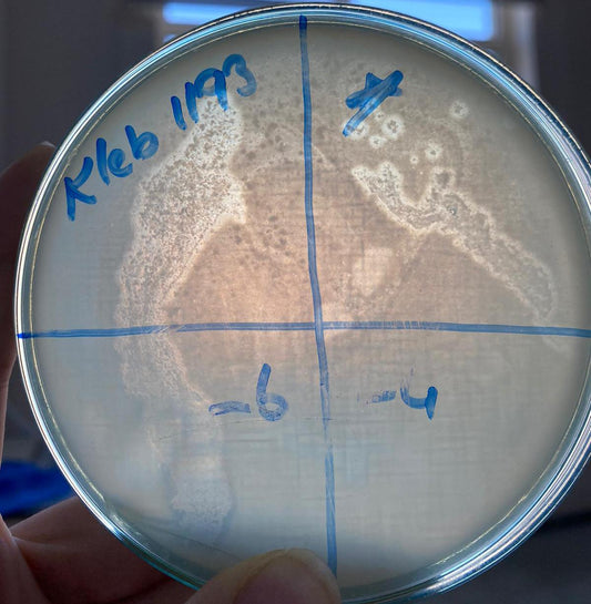 Klebsiella pneumoniae bacteriophage 181193A