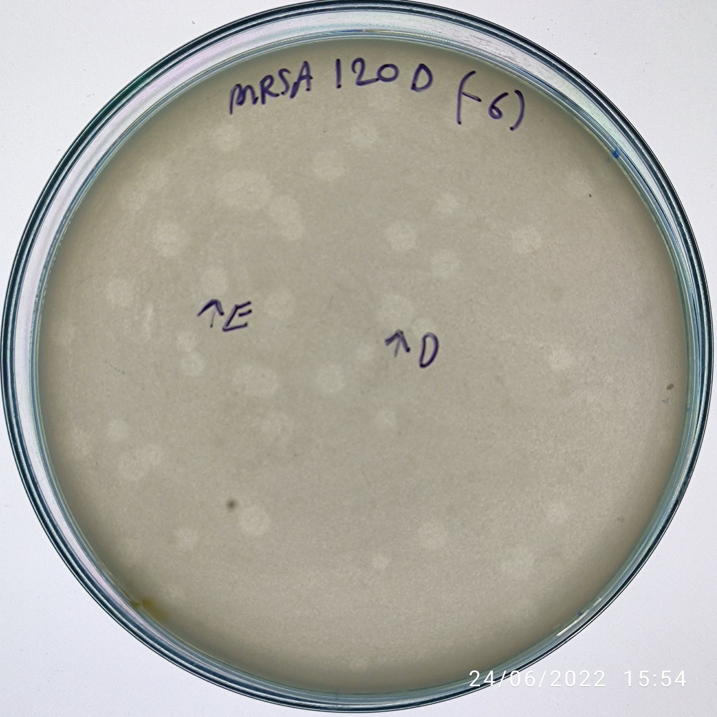 Staphylococcus aureus bacteriophage 150120E
