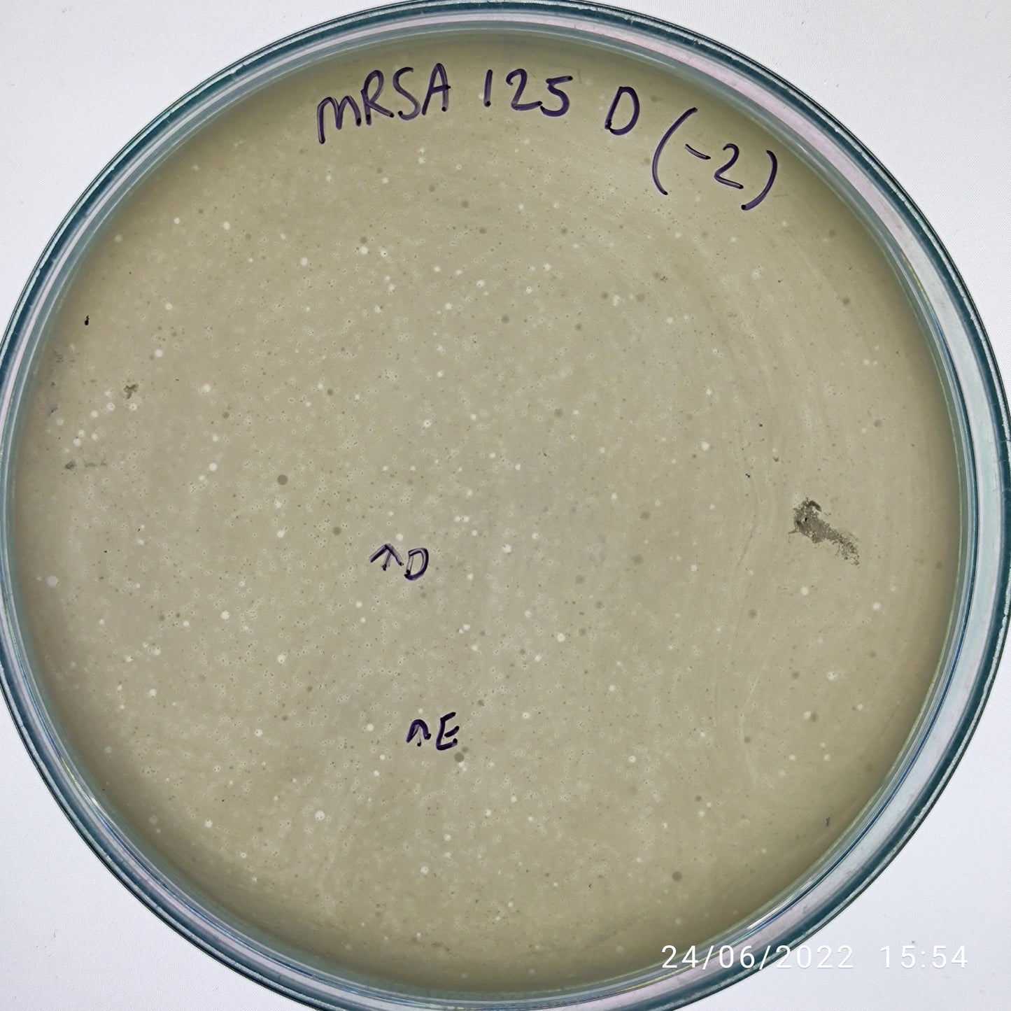 Staphylococcus aureus bacteriophage 150125D