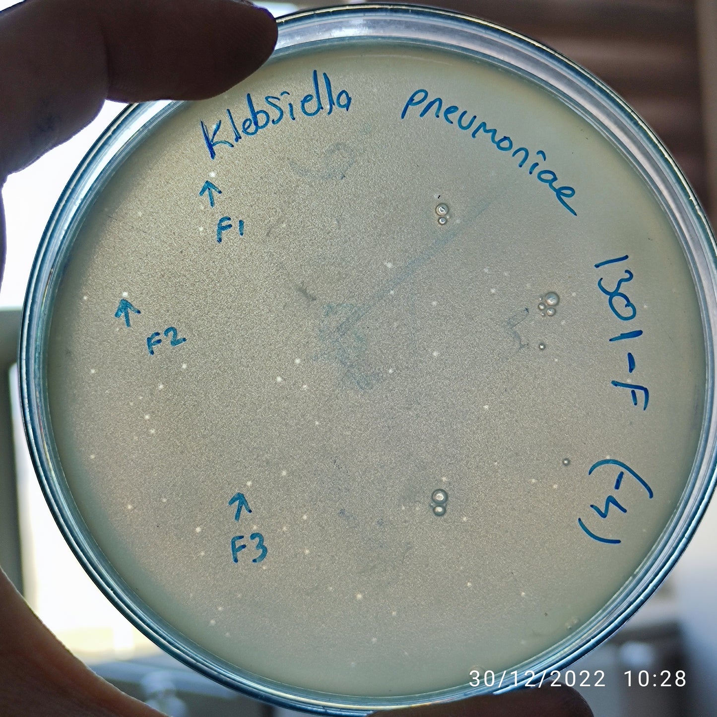 Klebsiella pneumoniae bacteriophage 181301F