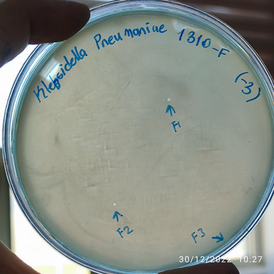 Klebsiella pneumoniae bacteriophage 181310F