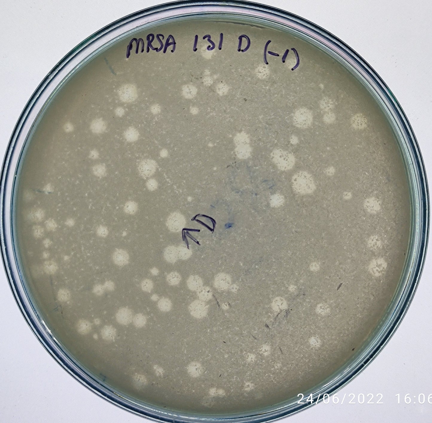 Staphylococcus aureus bacteriophage 150131D