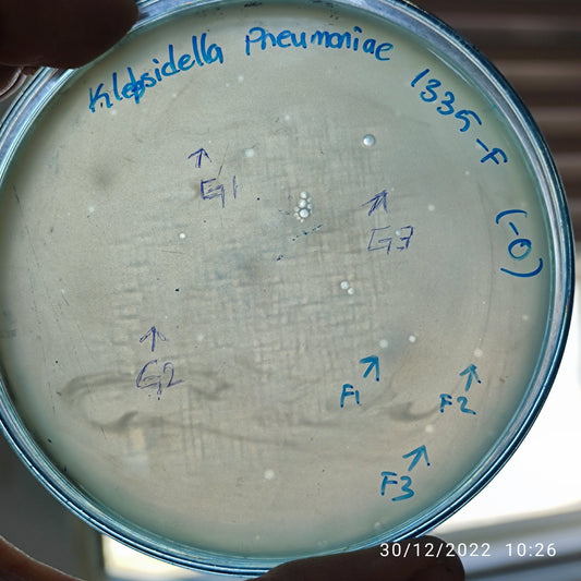 Klebsiella pneumoniae bacteriophage 181335F