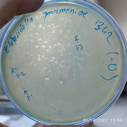 Klebsiella pneumoniae bacteriophage 181342F