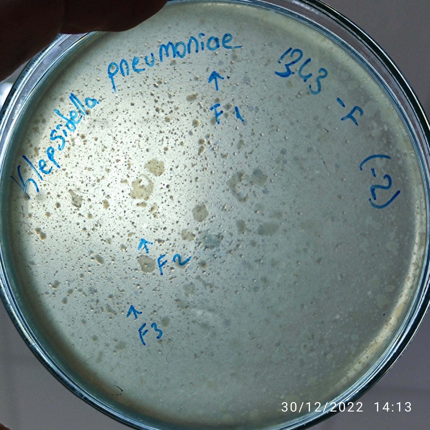 Klebsiella pneumoniae bacteriophage 181343F