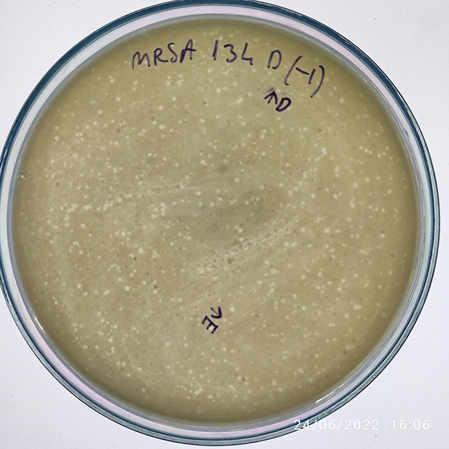 Staphylococcus aureus bacteriophage 150134D