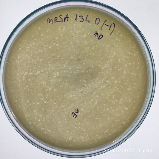 Staphylococcus aureus bacteriophage 150134D