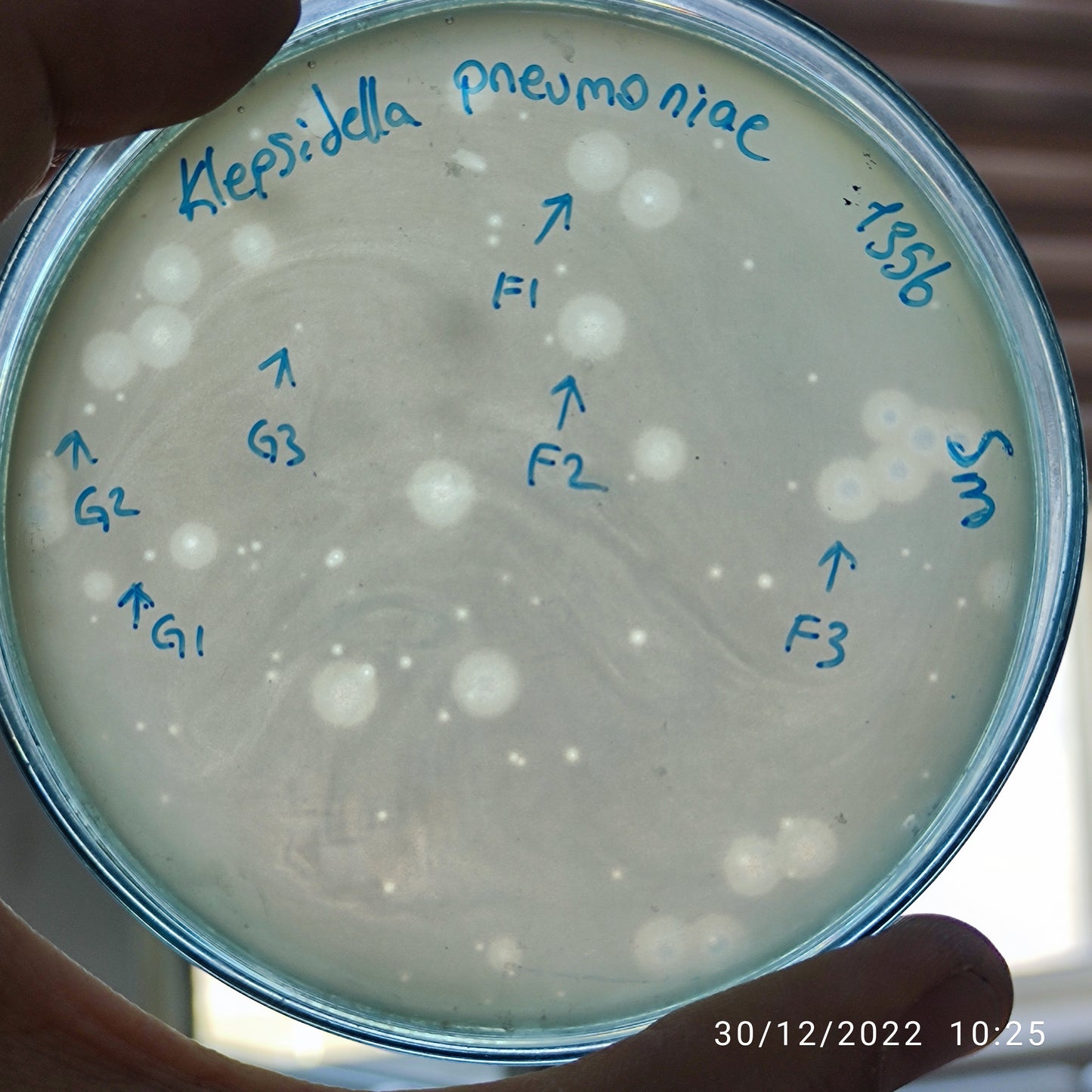 Klebsiella pneumoniae bacteriophage 181356F