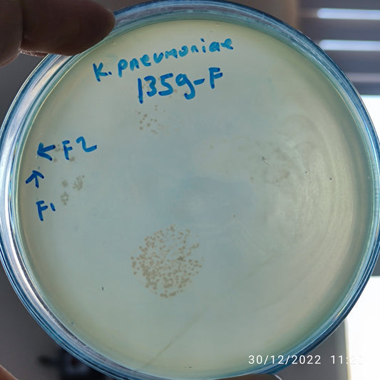 Klebsiella pneumoniae bacteriophage 181359F