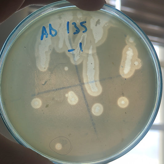 Acinetobacter baumannii bacteriophage 120135D