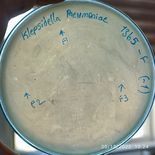 Klebsiella pneumoniae bacteriophage 181365F