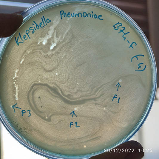 Klebsiella pneumoniae bacteriophage 181374F