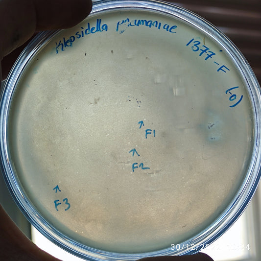 Klebsiella pneumoniae bacteriophage 181377F