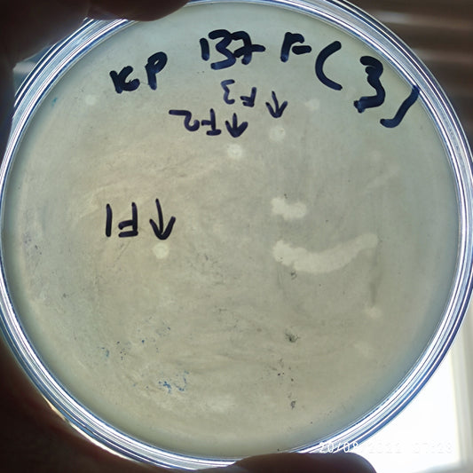 Klebsiella pneumoniae bacteriophage 180137F