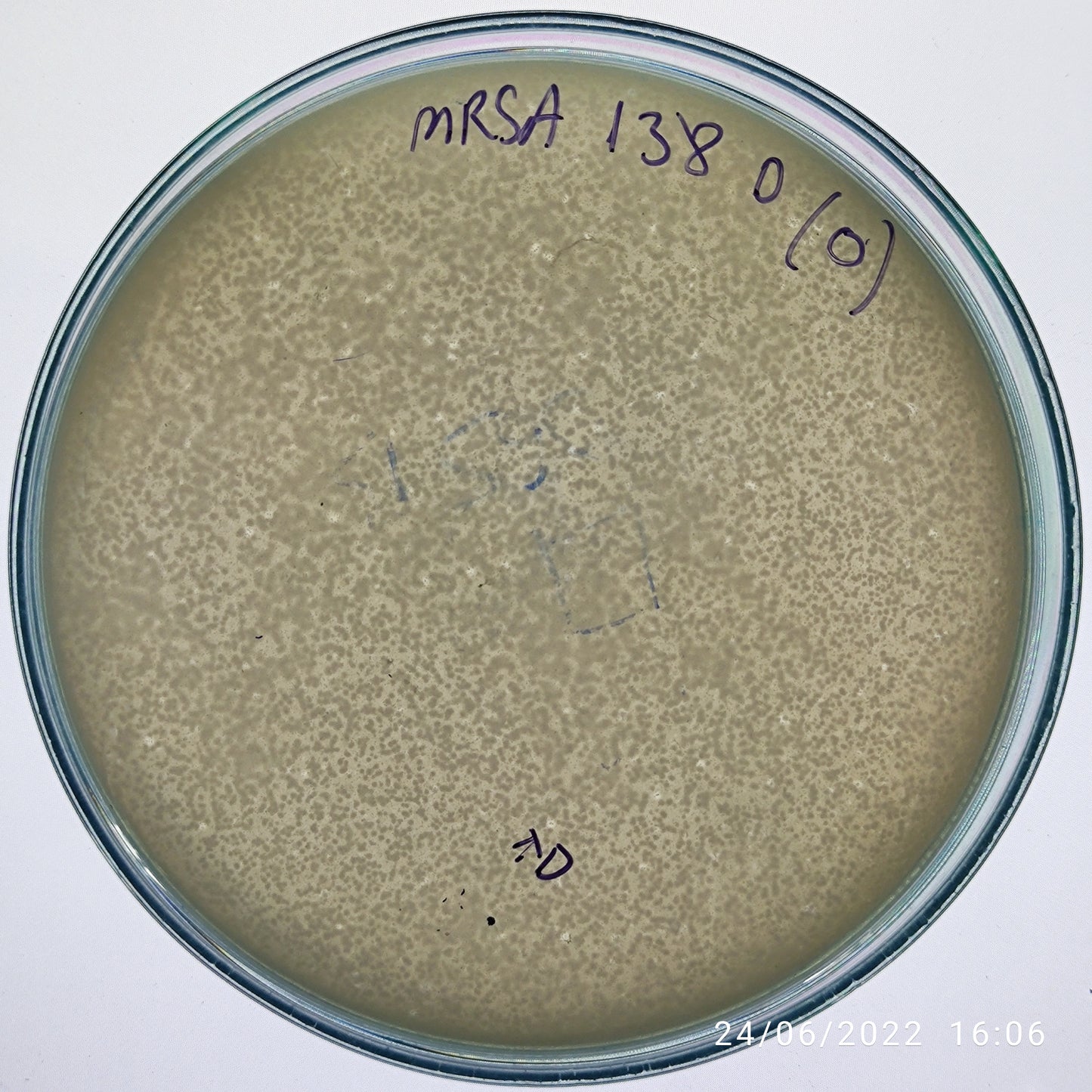 Staphylococcus aureus bacteriophage 150138D