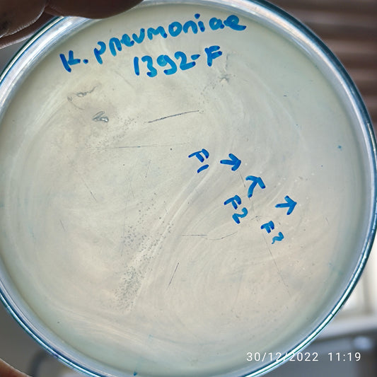 Klebsiella pneumoniae bacteriophage 181392F