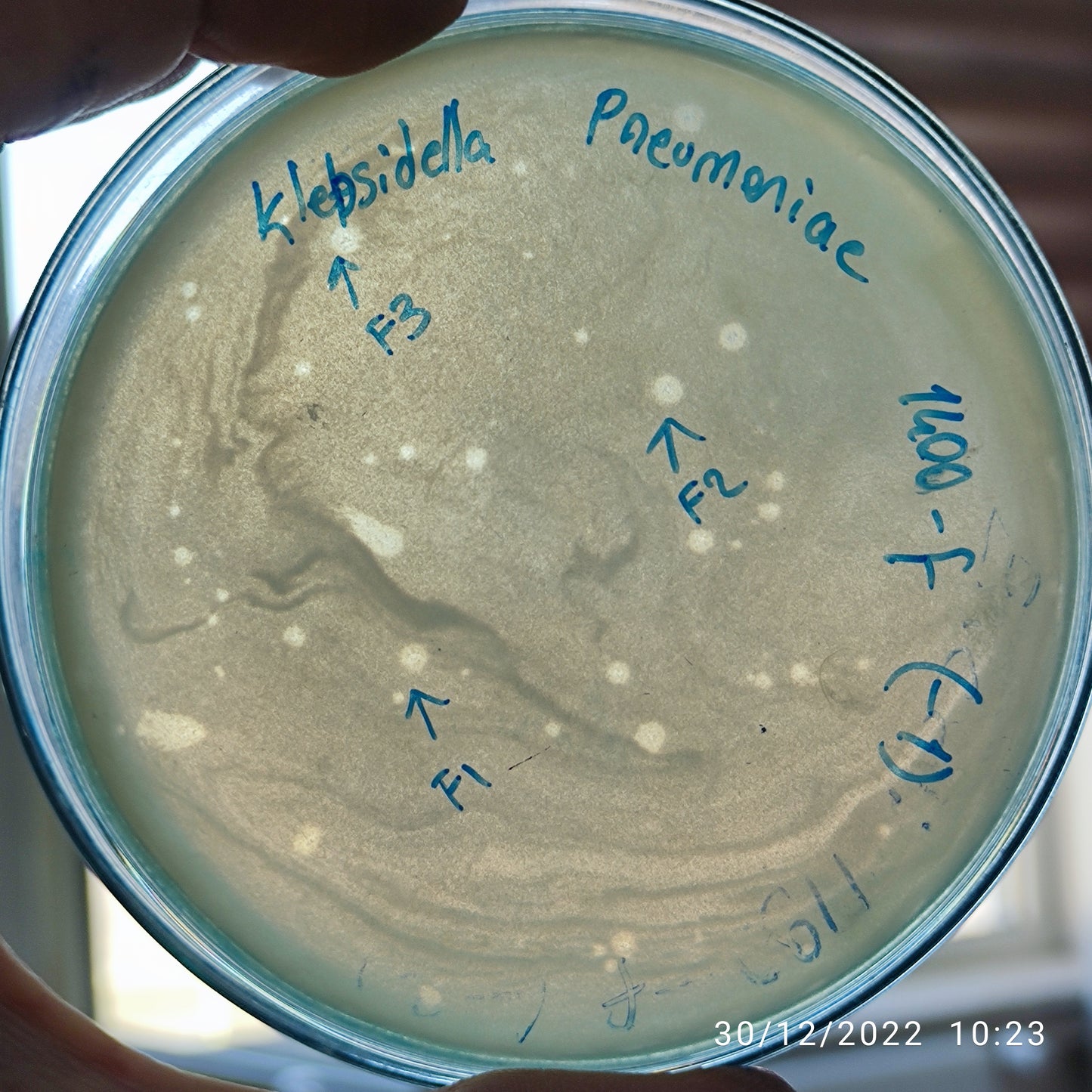 Klebsiella pneumoniae bacteriophage 181400F