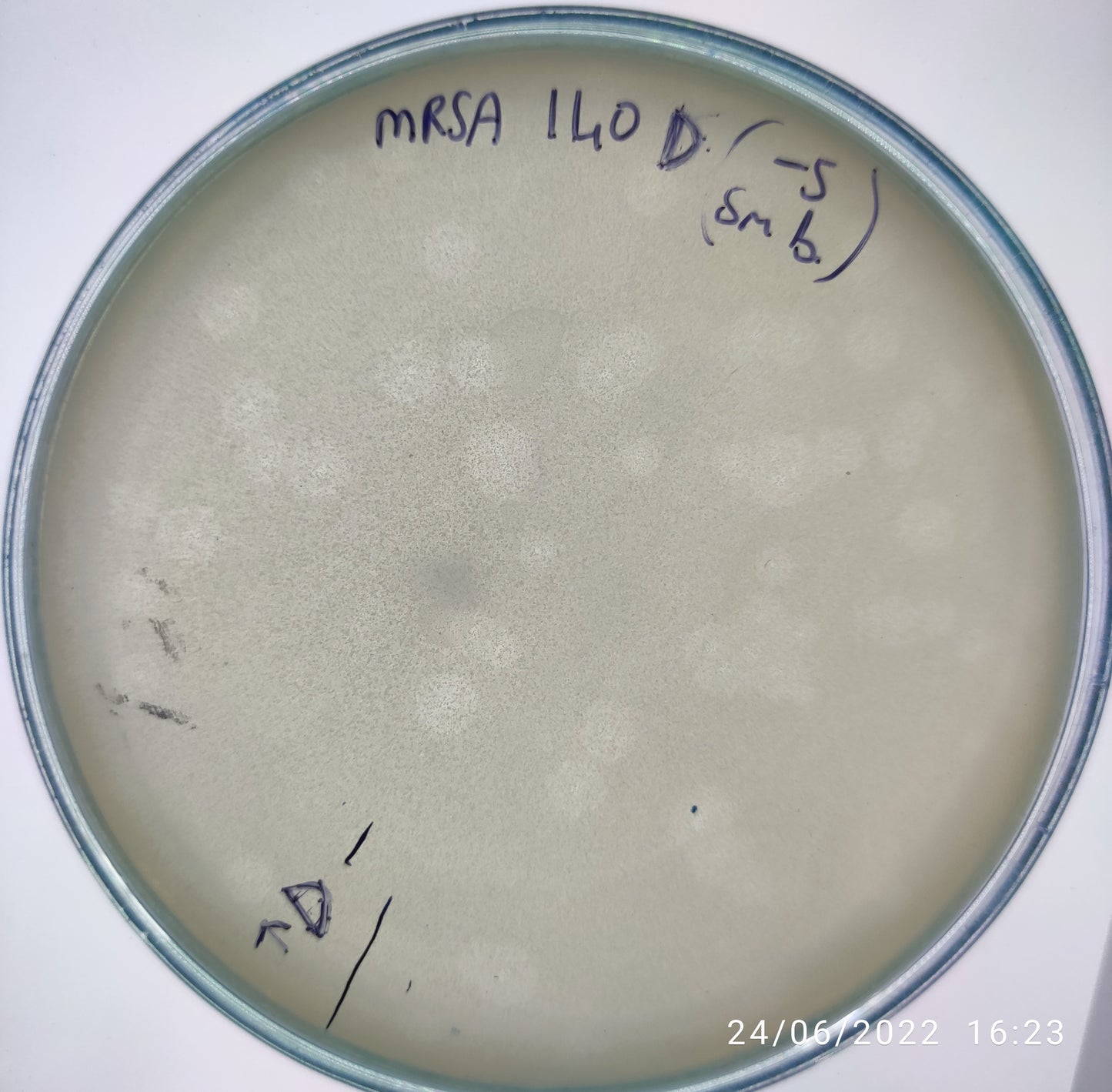 Staphylococcus aureus bacteriophage 150140D