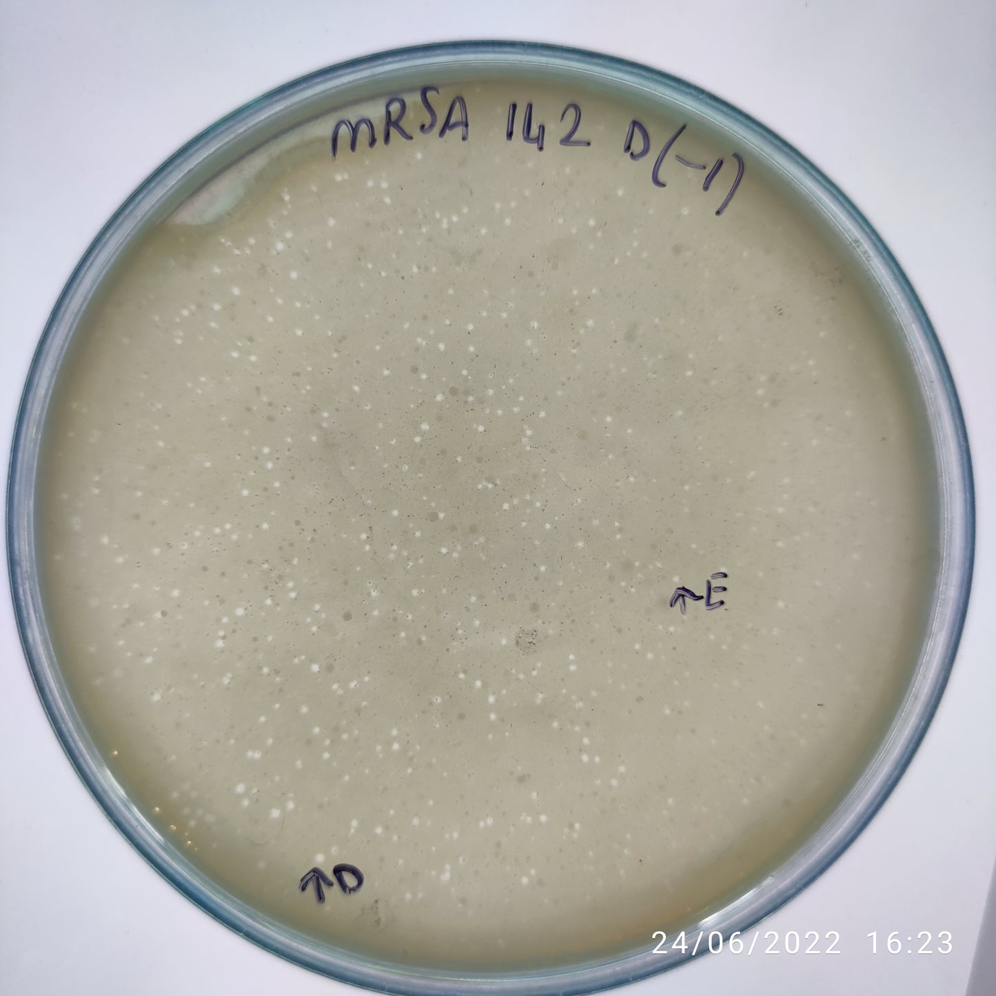 Staphylococcus aureus bacteriophage 150142E