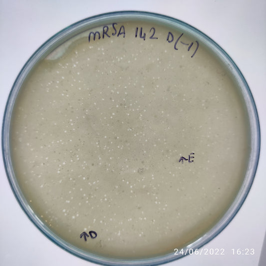 Staphylococcus aureus bacteriophage 150142E