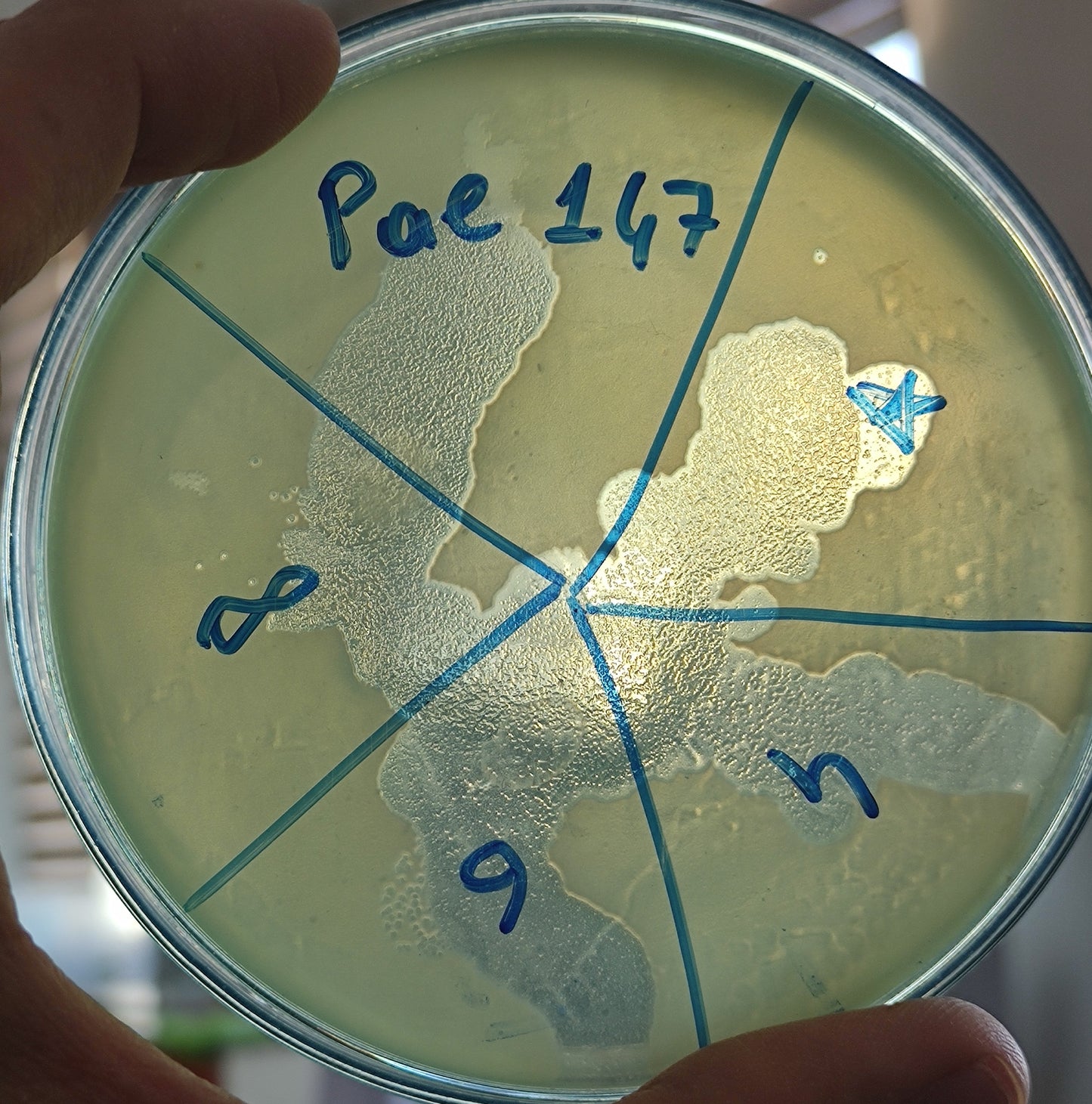 Pseudomonas aeruginosa bacteriophage 130147D