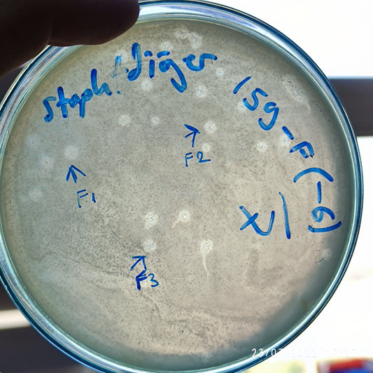 Staphylococcus haemolyticus bacteriophage 158159F